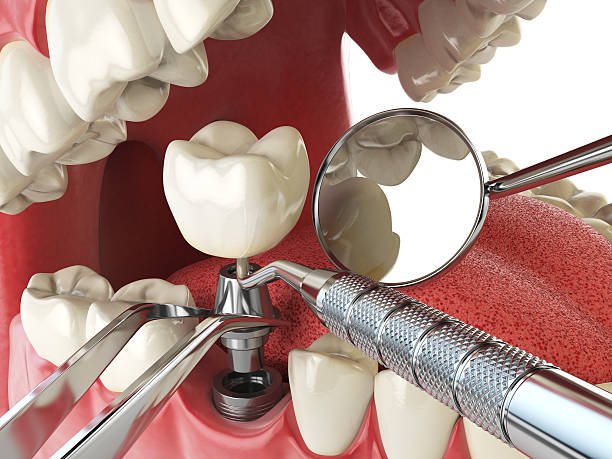 Best Knocked-Out Tooth Emergency  in Wagoner, OK